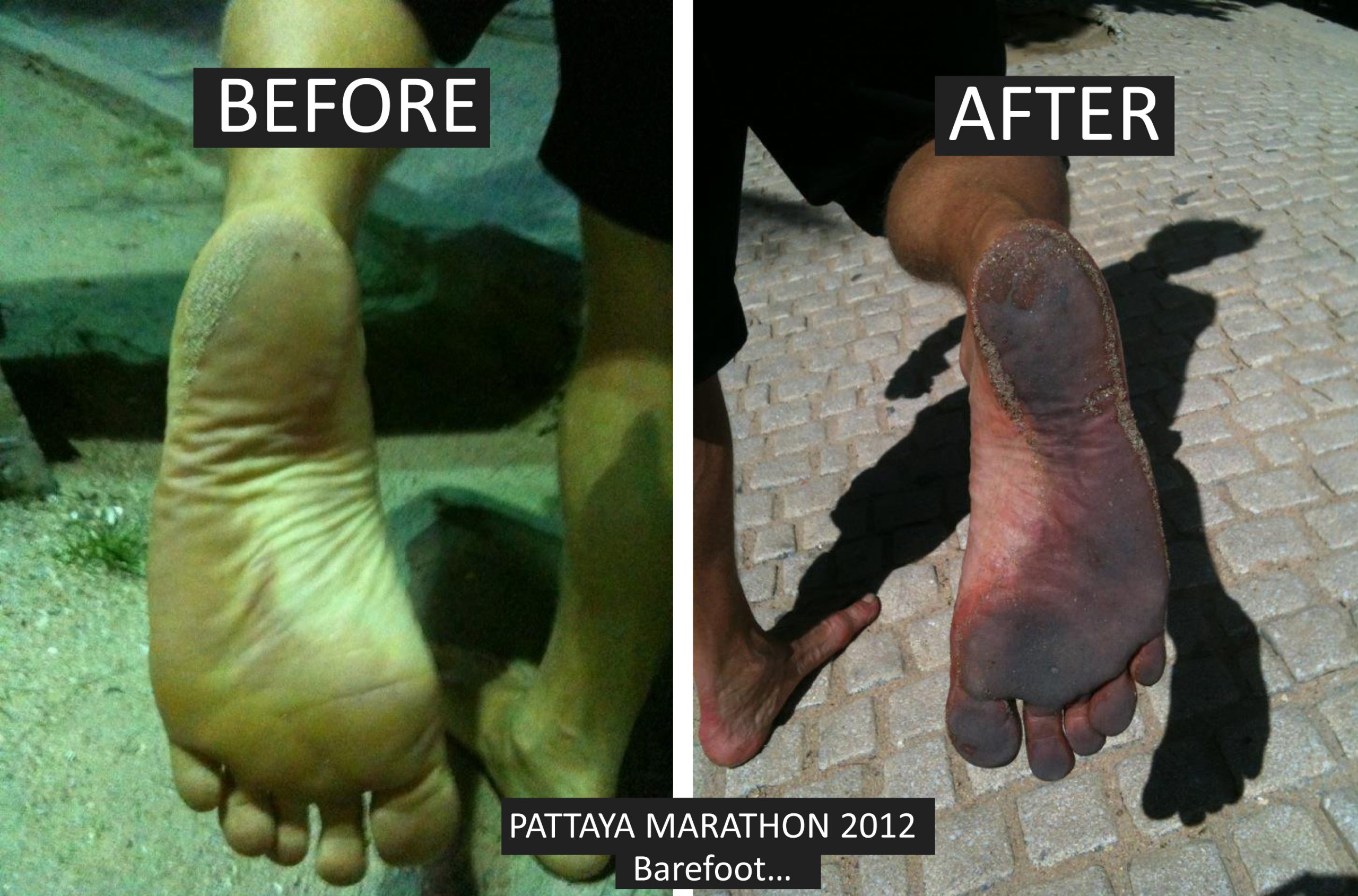 My barefoot Marathon – “the run” part 2